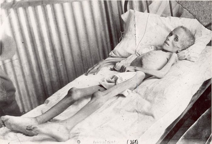 toto nie je fotka z Osvienčimu alebo iného nacistického koncetračného tábora ale z Južnej Afriky kde Angličania takto týrali afrikánske/búrske ženy a deti,dievča sa volalo Lizzie van Zyl
