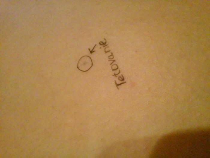 Moje dievca ma tetovanie! :D (ta bodka v kruzku)
Nejak divno, nahodou sa pichla pentelkou do zadku a ostala jej tam zalomena tuha.
Najoriginalnejsia kerka ever! :D