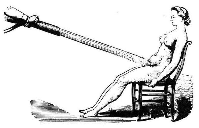 Vodní masážní přístroj pro léčbu ženské hysterie, cca 1865. 