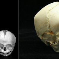 Naľavo lebka dospelého človeka v porovnaní s lebkou novorodenca. Napravo pohľad na lebku novorodenca.