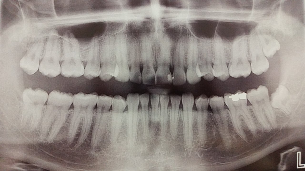Neviem prečo mi snímka zubov príde morbídna :D 