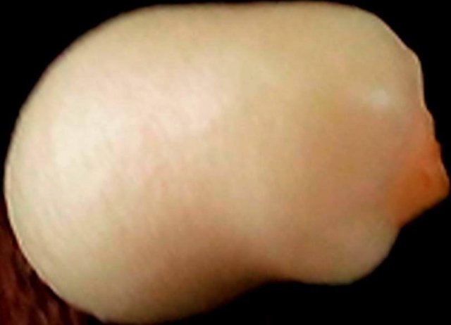 Embryo (Cocos nucifera)